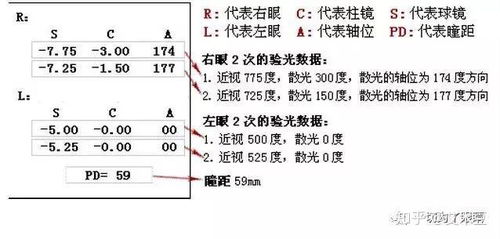 驗光配鏡時電腦小單怎么看
