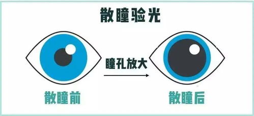 廣州哪個(gè)醫(yī)院眼科比較好 廣州最好的眼科醫(yī)院是哪家