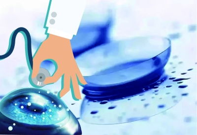 近視防控,ok鏡科學佩戴才ok