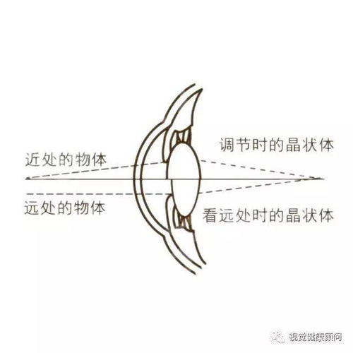 什么是醫學驗光 為什么說醫學驗光才準確